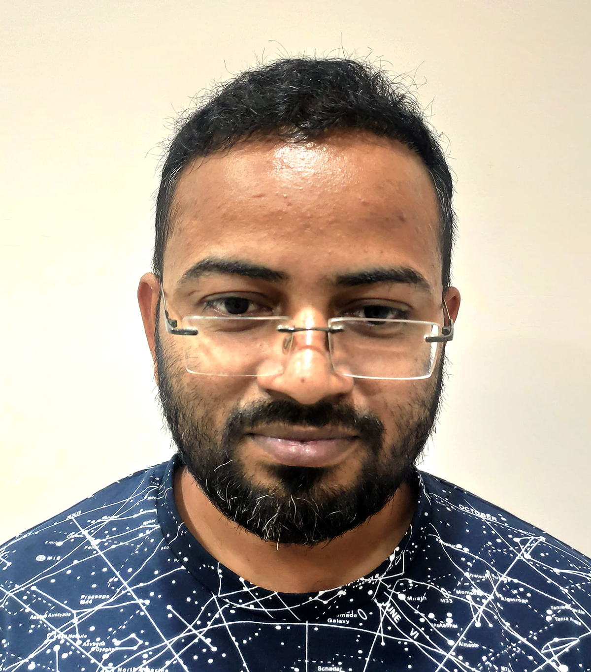 Hair-transplant-4-b Hair-transplant-4-b