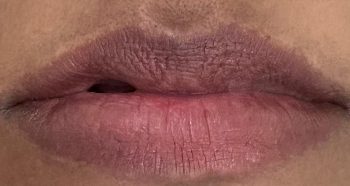 Lip-1-b Lip-1-b
