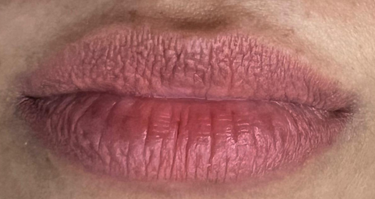 Lip-2-b Lip-2-b